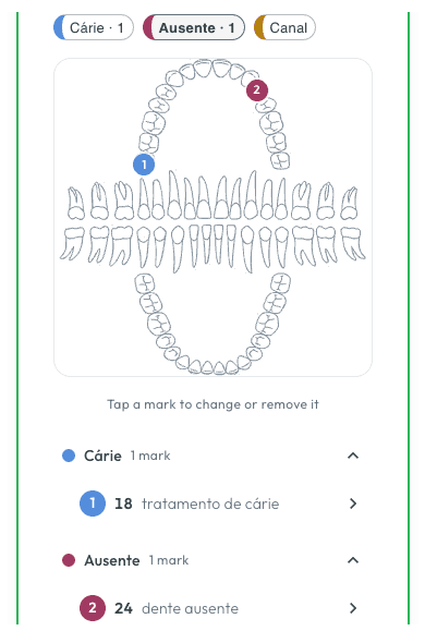 Capa: Odontograma Digital: Como Registrar o Exame Clínico no Prontuário Eletrônico
