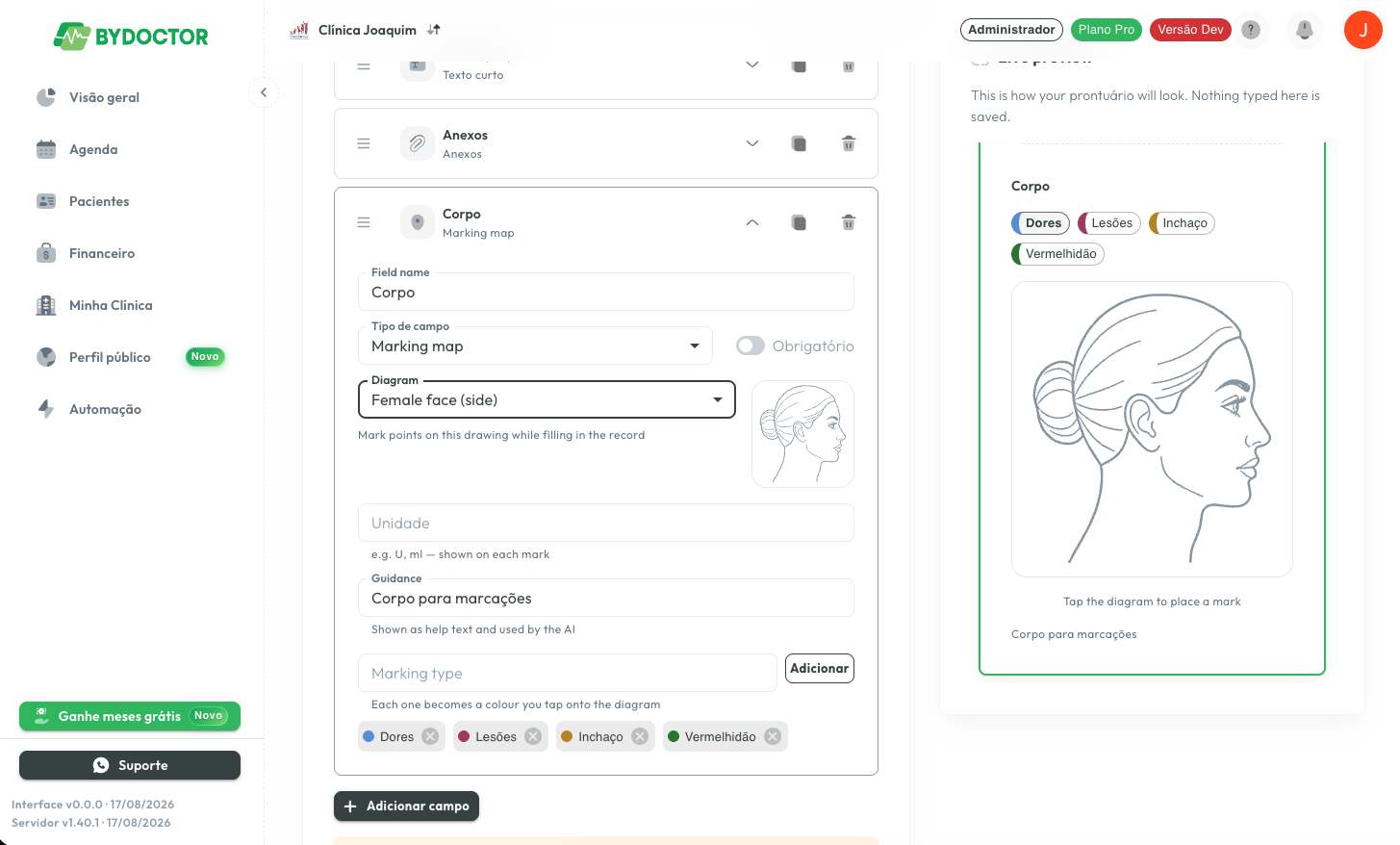 O mesmo campo com o diagrama de face de perfil selecionado